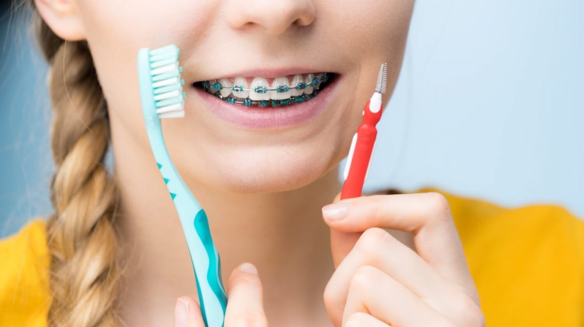 jak dbać o zęby pod aparatem ortodontycznym