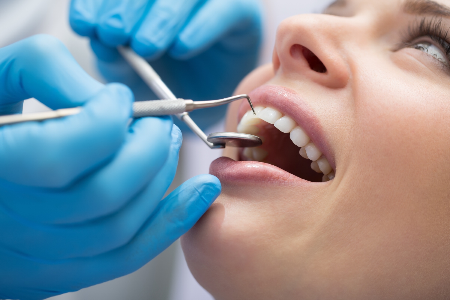 ortodoncja bezekstrakcyjna